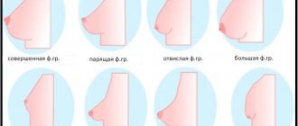 форма груди