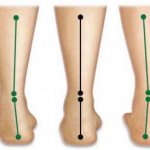 подъем гантелей с супинацией