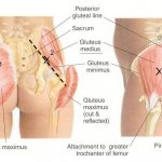 средняя ягодичная мышца