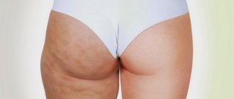 Remove riding breeches