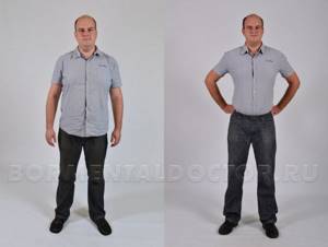 Воронцов похудение фото до и после
