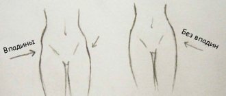 Depressions on the buttocks